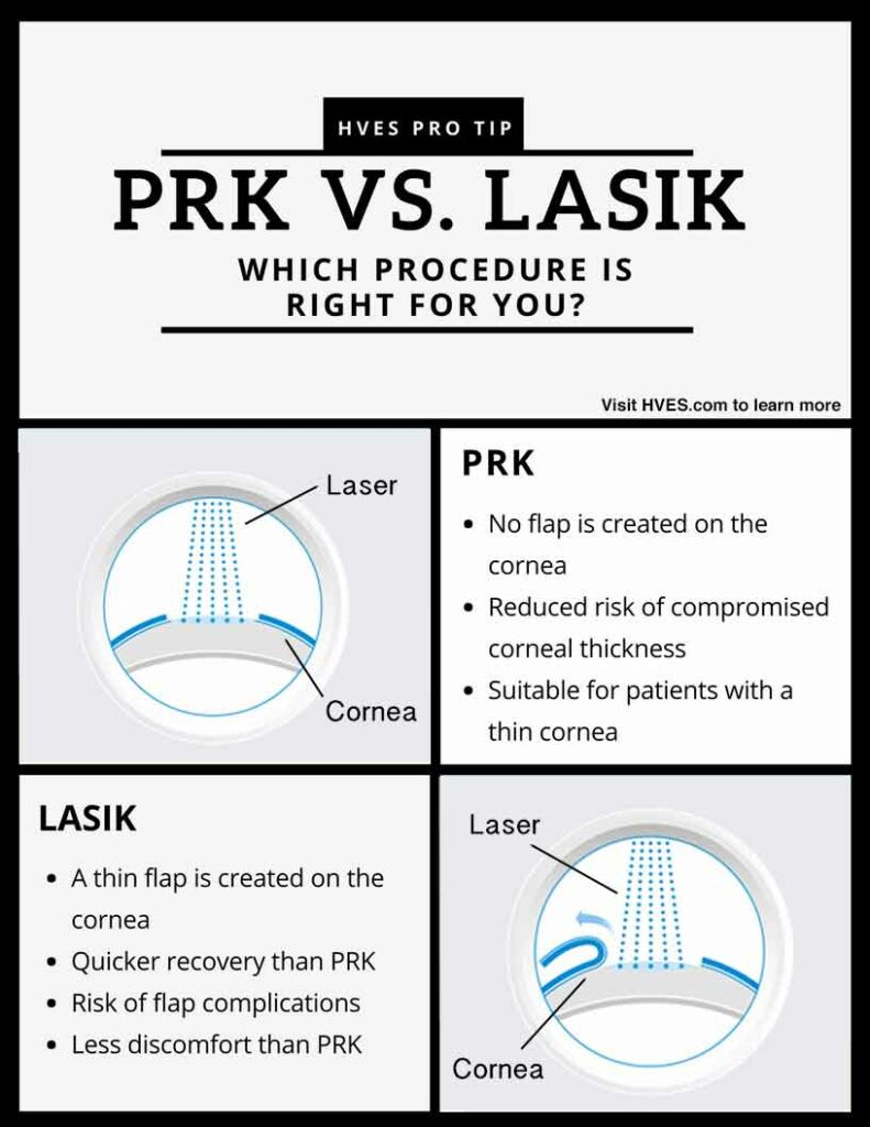 PRK VS LASIK Chart