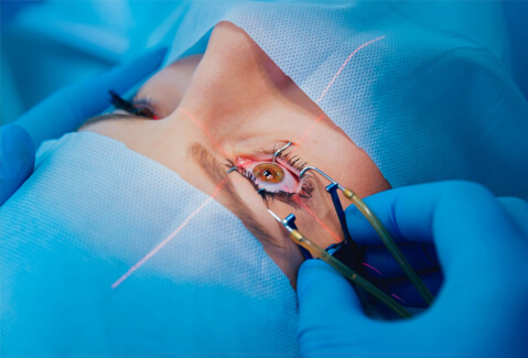 Woman getting LASIK surgery