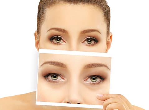 Woman holding a before photo of upper and lower blepharoplasty